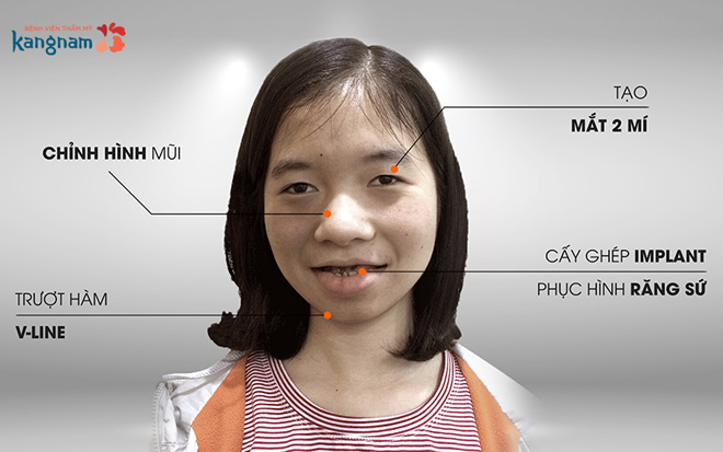 108 ngày, 5 lần PTTM - chặng đường gian nan tìm lại nụ cười của cô gái “ma cà rồng” - 3