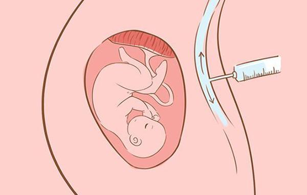 Sinh mổ không chỉ giúp mẹ đỡ đau đẻ mà còn có những lợi ích bất ngờ - 2