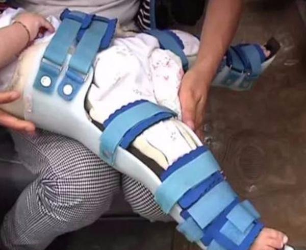 Tin lời amp;#34;thầy rởmamp;#34; chữa chân cho con bằng massage, mẹ đau lòng khi nhận kết quả - 3