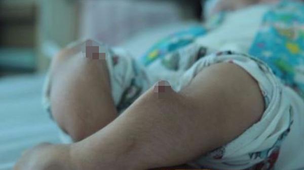 Tin lời amp;#34;thầy rởmamp;#34; chữa chân cho con bằng massage, mẹ đau lòng khi nhận kết quả - 1