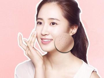 Trị tàn nhang hiệu quả ngay tại nhà với 7 nguyên liệu chưa đến 10.000 đồng!