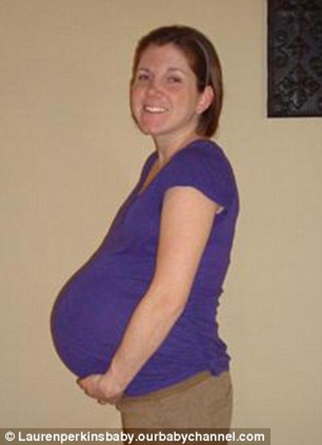 6 em bé chào đời trong ca đẻ mổ với sự giúp đỡ của 35 bác sĩ giờ ra sao? - 1