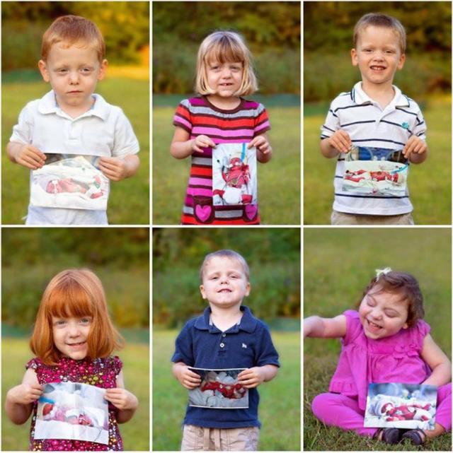 6 em bé chào đời trong ca đẻ mổ với sự giúp đỡ của 35 bác sĩ giờ ra sao? - 6