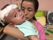 Làm mẹ - Rớt nước mắt cảnh bé 10 tháng tuổi phải trải qua 9 lần phẫu thuật đau đớn