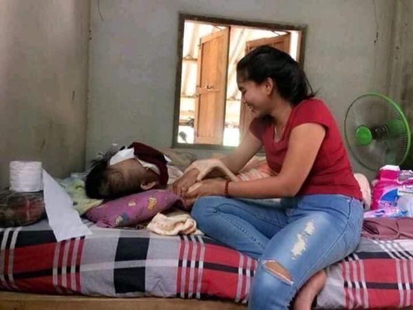 Chuyện tình cảm động của cô gái trẻ và chàng trai bị biến dạng mặt vì ung thư mắt - 5