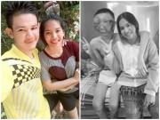 Yêu - Chuyện tình cảm động của cô gái trẻ và chàng trai bị biến dạng mặt vì ung thư mắt