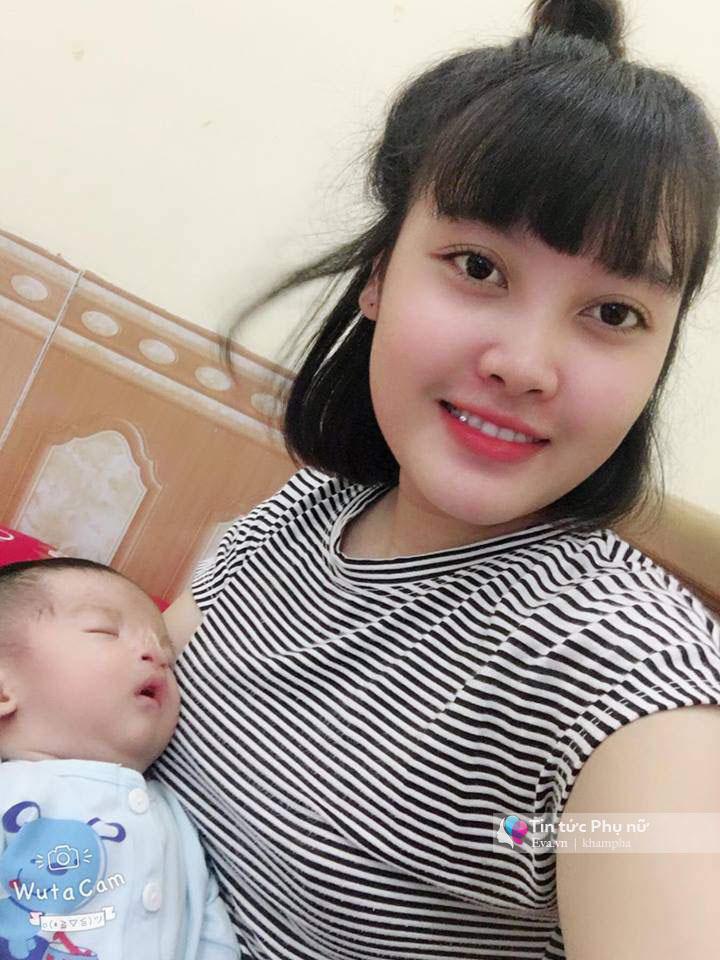 Lỡ uống thuốc khi mới cấn thai, mẹ Ninh Bình xót lòng nhìn con sinh ra không có mũi - 4