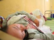 Sức khỏe - Sốt xuất huyết nguy cơ thành dịch: Muốn không mắc bệnh cần thực hiện những biện pháp này hàng ngày?