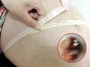 Bà bầu - Mang thai suốt 17 năm, mẹ sốc nặng khi sinh ra vật thể lạ có cả răng và tóc