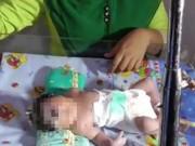 Bà bầu - Suốt 9 tháng không siêu âm thai, đến lúc sinh con bố mẹ suýt ngất khi nhìn mặt