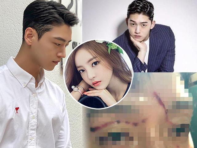 Búp bê xứ Hàn cào người yêu rách mặt, khuôn mặt điển trai giờ không ai nhận ra