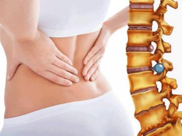Điều trị thoát vị đĩa đệm ra sao?