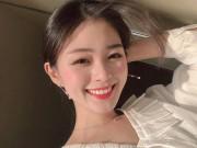 Làm đẹp - 9 Cách làm trắng răng bằng các nguyên liệu đơn giản tại nhà