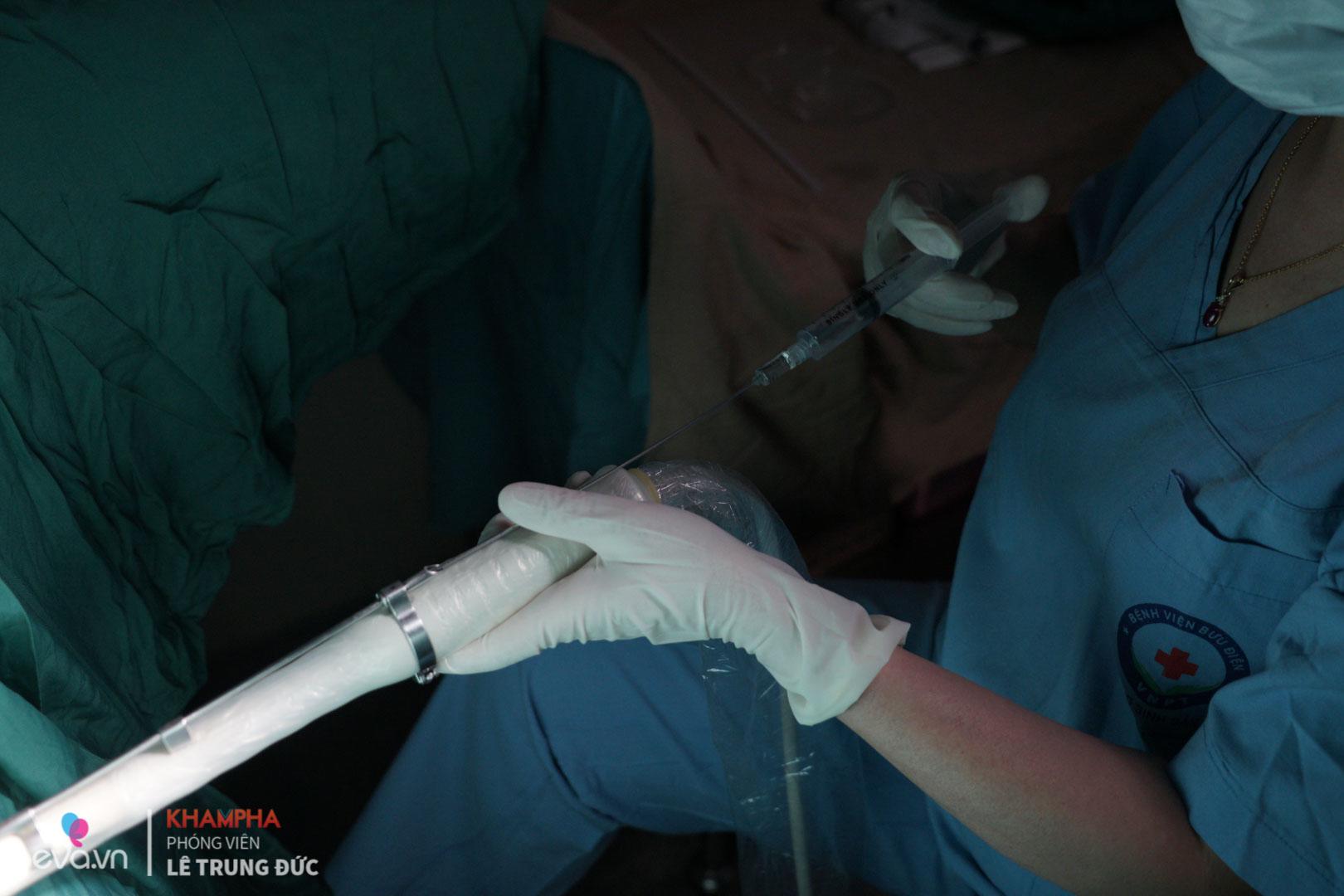 can canh quy trinh dong lanh trung tai viet nam rat nhieu chi em hien dai dang muon thuc hien - 6