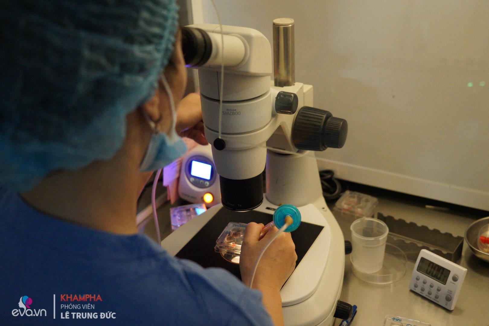 can canh quy trinh dong lanh trung tai viet nam rat nhieu chi em hien dai dang muon thuc hien - 11