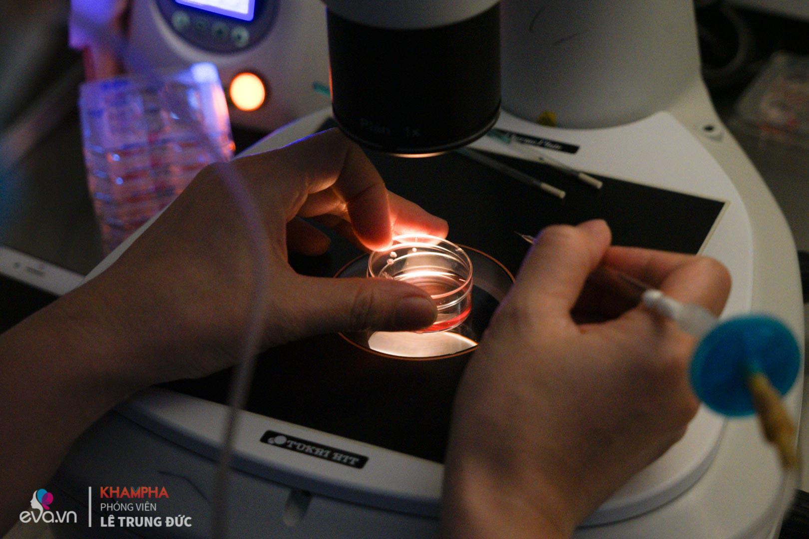 can canh quy trinh dong lanh trung tai viet nam rat nhieu chi em hien dai dang muon thuc hien - 8