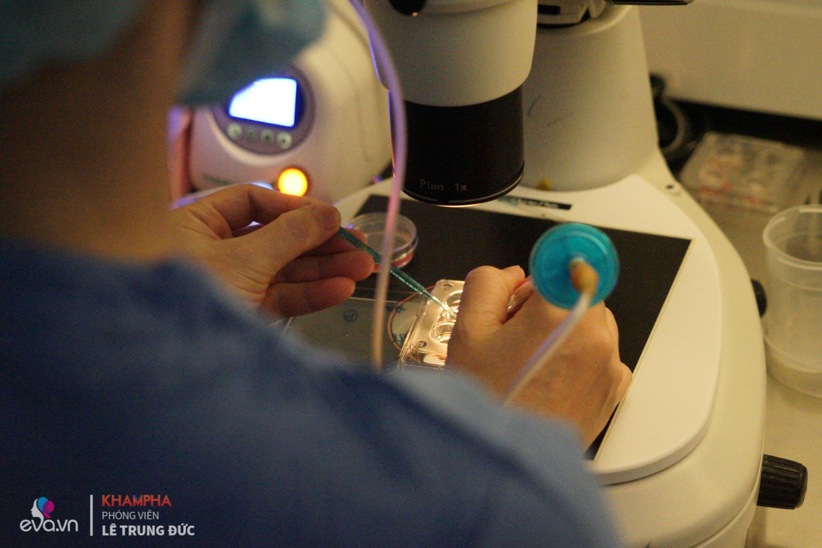 can canh quy trinh dong lanh trung tai viet nam rat nhieu chi em hien dai dang muon thuc hien - 9