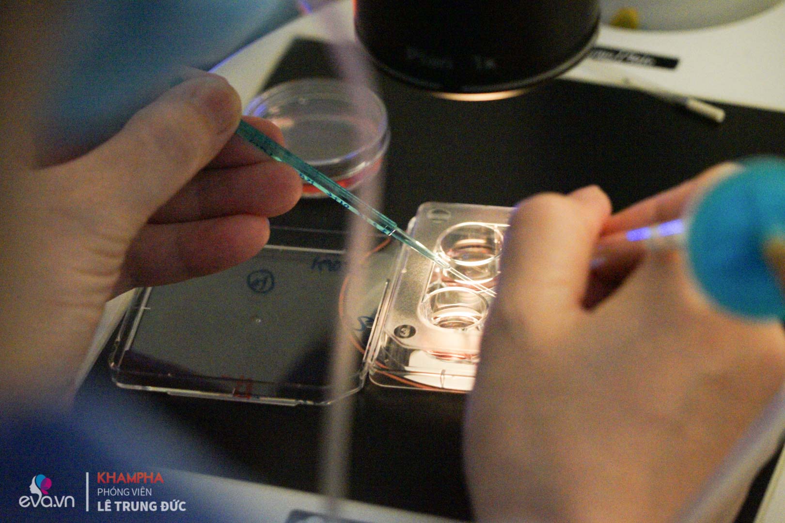 can canh quy trinh dong lanh trung tai viet nam rat nhieu chi em hien dai dang muon thuc hien - 12