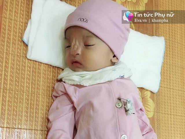 Mẹ Ninh Bình quặn lòng sinh con không mũi: Cảnh báo những loại thuốc tránh dùng khi mang thai