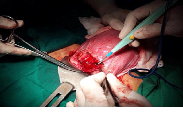 Sản phụ sinh con tại nhà gặp biến chứng nguy hiểm, hai mẹ con suýt mất mạng - 2