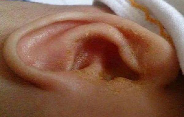 Thấy con hay sờ đầu, gãi tai, mẹ ngỡ ngàng khi biết con mắc bệnh lúc nào không hay - 2