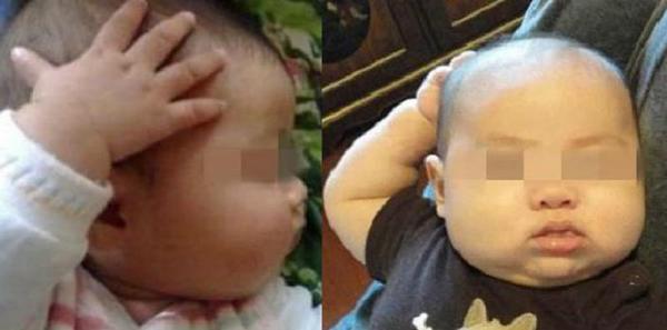 Thấy con hay sờ đầu, gãi tai, mẹ ngỡ ngàng khi biết con mắc bệnh lúc nào không hay - 1