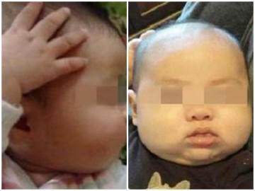 Thấy con hay sờ đầu, gãi tai, mẹ ngỡ ngàng khi biết con mắc bệnh lúc nào không hay