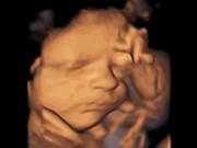 Bà bầu - Khoảnh khắc thai nhi ăn, hắt hơi và khóc trong bụng mẹ cực đáng yêu