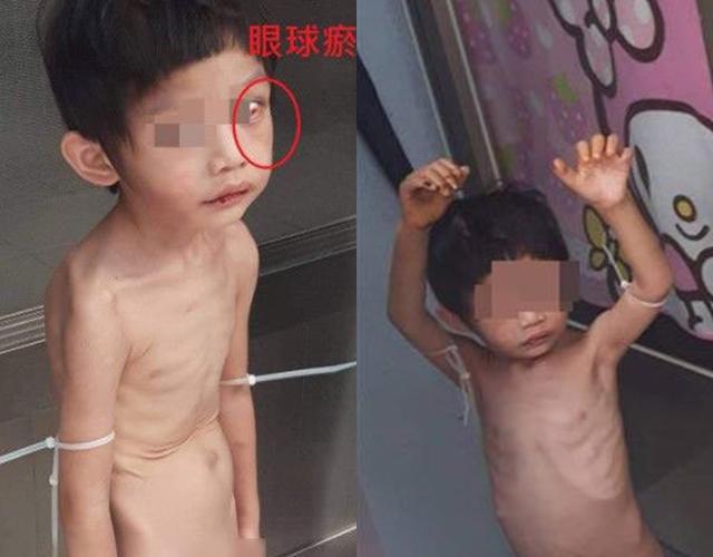 tin tuc 24h: me hot hoang khi con trai bi chong cu troi tay, ben canh phan va nuoc tieu - 1