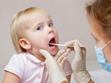 Viêm amidan: Triệu chứng, nguyên nhân và cách chữa