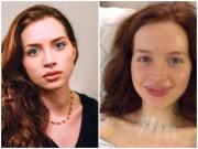 Sức khỏe - Bức ảnh tố dấu hiệu ung thư tuyến giáp từ 1 năm trước nhưng cô gái không nhận ra