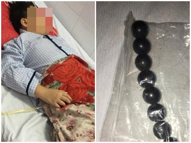 Vụ đứa trẻ bị bạn ép nuốt 9 viên bi nam châm: Hãy dạy trẻ cách yêu bản thân