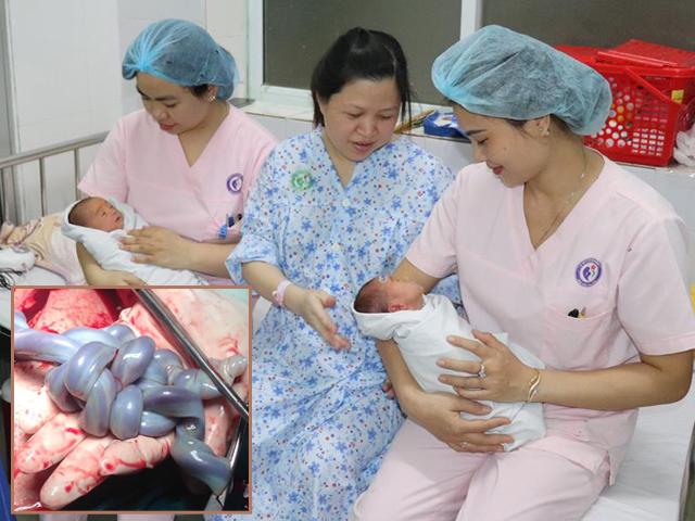 Mẹ Hải Phòng mổ cấp cứu vì song thai ít cử động, nhìn dây rốn bác sĩ cũng sững sờ