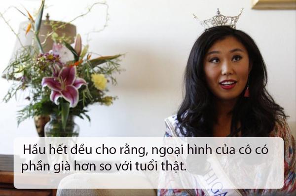 that bat ngo, le au ngan anh lot top hoa hau... bi che xau nhat the gioi - 14