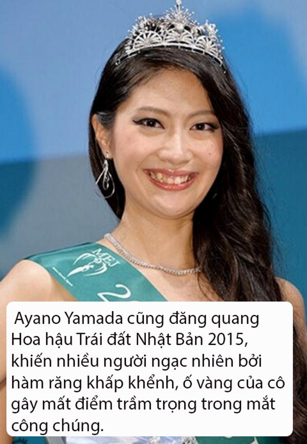 that bat ngo, le au ngan anh lot top hoa hau... bi che xau nhat the gioi - 9