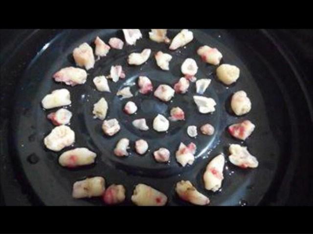 be trai 2 tuoi co 50 chiec rang, 7 nam sau nhin phim chup khoang mieng ai cung sung so - 2