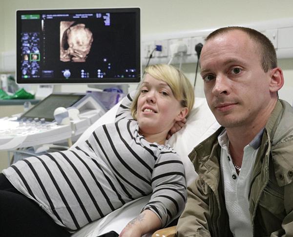 bat chap moi canh bao cua bac si, cap doi "ti hon" quyet tam mang bau lan 2 - 4