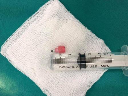 vua duoc dua den vien, be 6 tuoi lap tuc ngung tim, ngung tho vi nguyen nhan nay - 1