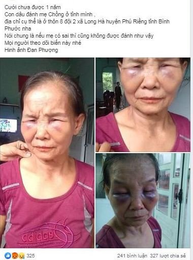 Con dâu túm tóc đánh mẹ chồng sưng mắt, tím mặt khiến MXH dậy sóng - 2