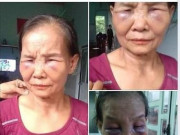 Tin tức - Con dâu túm tóc đánh mẹ chồng sưng mắt, tím mặt khiến MXH dậy sóng