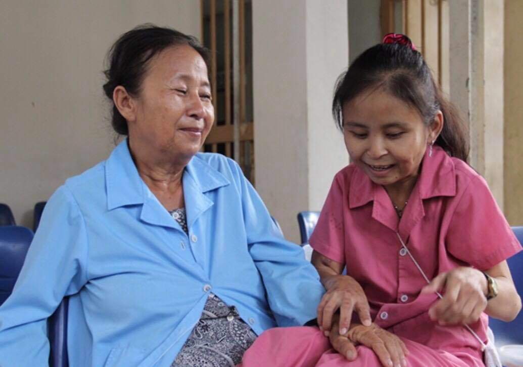 con gai sinh ra chi co mot qua than, nguoi me danh ca doi niu su song cho con - 3