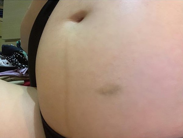 Đang mang bầu thấy bụng thâm tím, Yumi Dương bất ngờ khi phát hiện amp;#34;thủ phạmamp;#34; - 2