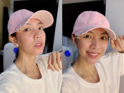 Làm đẹp - Hoa hậu hài Thu Trang lộ gương mặt căng phồng, cứng đơ, thiếu tự nhiên?