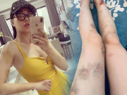 Thời trang - Bầm dập thâm tím vì ghi hình, Quỳnh Búp Bê Phương Oanh vẫn diện váy hở bạo sexy