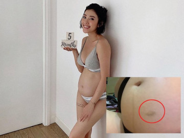 Đang mang bầu thấy bụng thâm tím, Yumi Dương bất ngờ khi phát hiện "thủ phạm"