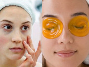 Làm đẹp - 4 cách điều trị thâm quầng quanh mắt cực đơn giản
