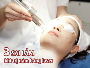 Sai một ly đi một dặm, đây là 3 sai lầm khi trị nám bằng laser khiến da không đẹp