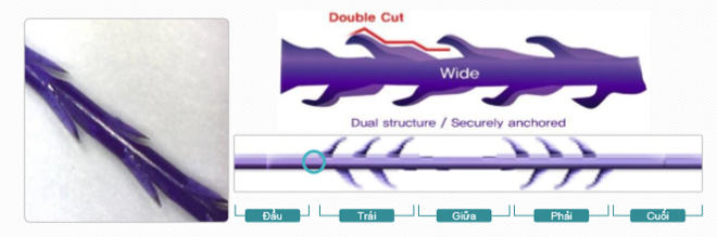 Giải mã công nghệ nâng cơ trẻ hóa bằng chỉ Collagen Ultra Diamond đang gây amp;#34;sốt” cộng đồng làm đẹp - 1