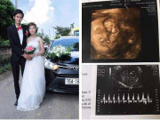 Bà bầu - Thai nghén uống nước cũng nôn, mẹ Hải Phòng xót xa đẻ con tuần 28 được vỏn vẹn 5 lạng