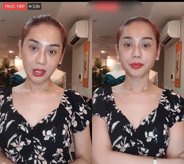 Sau lần gây sốc với khuôn mặt sần sùi, Lâm Khánh Chi mạnh dạn tuyên bố “đẹp bất chấp” - 1